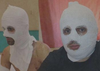 Biri gaz sıkarken oburu çakmak çaktı; patlamada 2 kişi yaralandı: Ortalık bir anda masmavi oldu