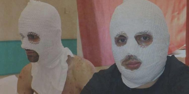 Biri gaz sıkarken oburu çakmak çaktı; patlamada 2 kişi yaralandı: Ortalık bir anda masmavi oldu