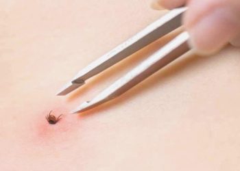 Giresun’da kene can aldı!