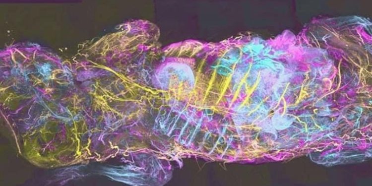 Şeffaf görüntüleme teknolojisi yapay zekayla kansere tahlil sunacak