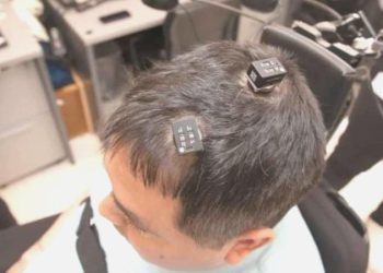 Yapay zeka dayanaklı beyin implantı ihtilal yaratabilir