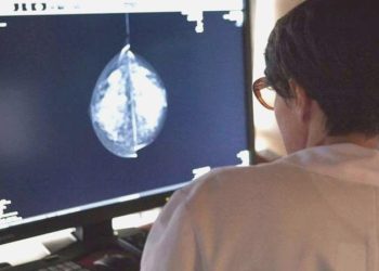 Yapay zeka göğüs kanseri tespitinde başarılı oldu