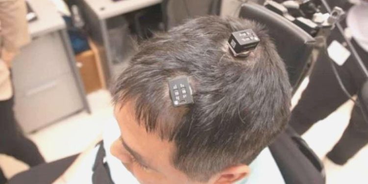 Yapay zeka takviyeli beyin implantı ihtilal yaratabilir