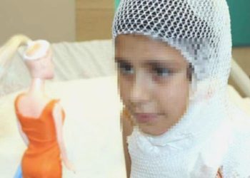 11 yaşındaki çocuk ‘kolonya yakma’ görüntüsü çekerken ağır yaralandı