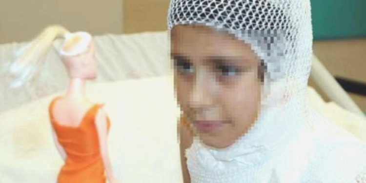 11 yaşındaki çocuk ‘kolonya yakma’ görüntüsü çekerken ağır yaralandı