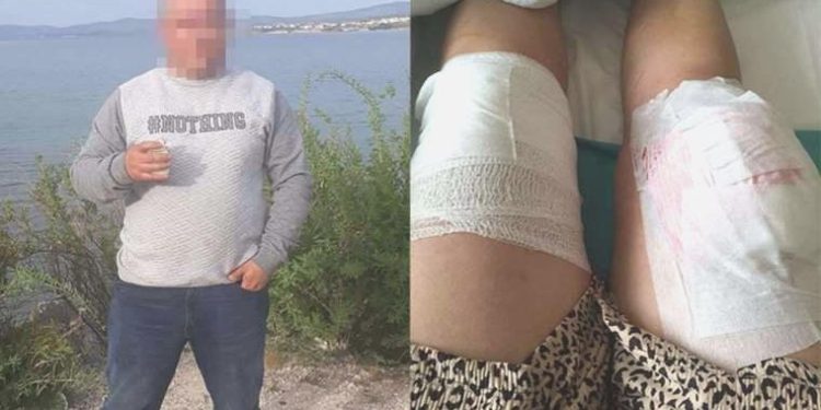 Boşandığı bayana silahlı taarruzda bulunan erkek hakkında istenen ceza aşikâr oldu!