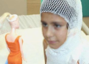 Görüntü çekerken kendini yaktı