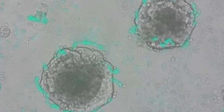 Kanser hücrelerini tespit etmek için bakteriler geliştirildi