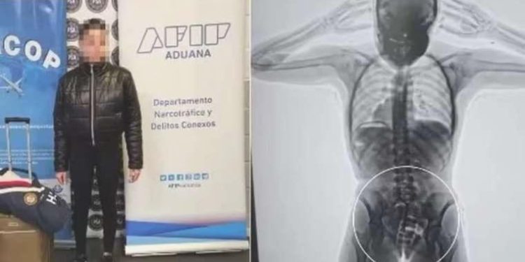 Vajinasına sakladığı yüklü ölçüde uyuşturucu X-ray aygıtına takıldı