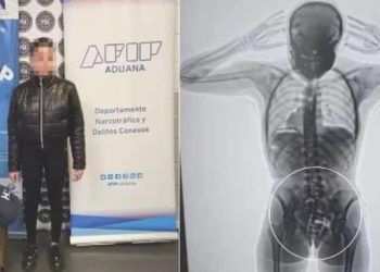 Vajinasına sakladığı yüklü ölçüde uyuşturucu X-ray aygıtına takıldı