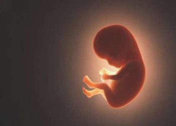 Meksika’da 84 yaşındaki bayanın karnında 40 yıllık cenin bulundu