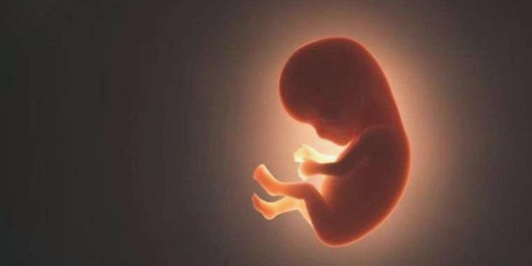 Meksika’da 84 yaşındaki bayanın karnında 40 yıllık cenin bulundu