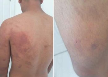 Baba ve amca dehşeti yaşattı: 16 yaşındaki çocuğa azap argümanı