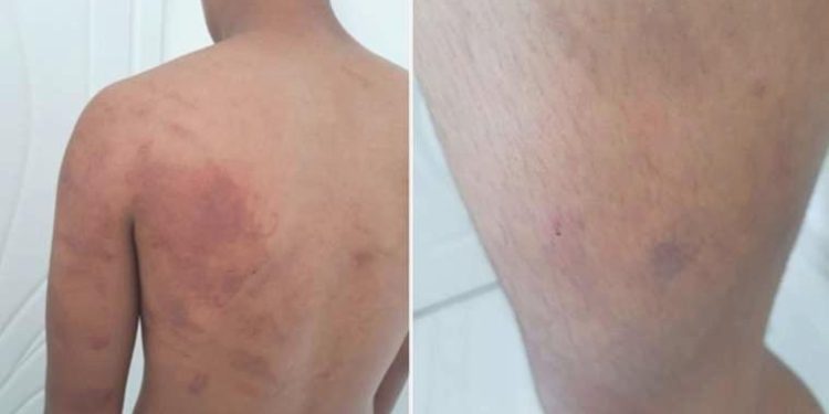 Baba ve amca dehşeti yaşattı: 16 yaşındaki çocuğa azap argümanı