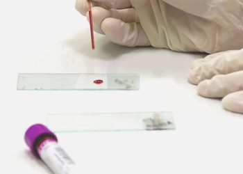 Bağışıklık sistemini direkt etkileyen ‘monosit’ nedir?