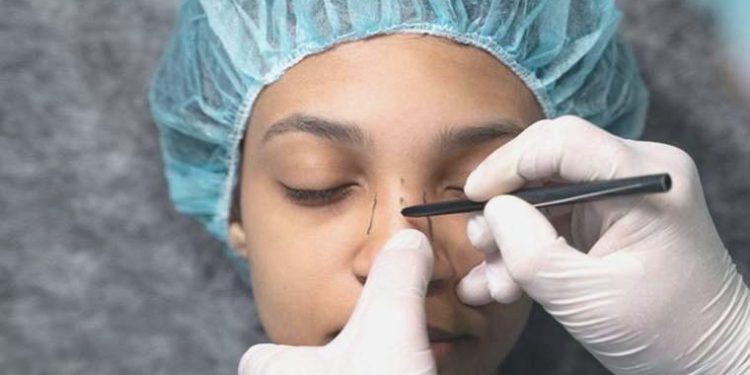 Burun ameliyatı olanlar dikkat: Güneş kalıcı hasar verebilir!