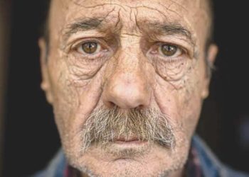 Cilt sıhhati ve yaşlanmaya bağlı hastalıklar ortasında nasıl bir bağlantı var?