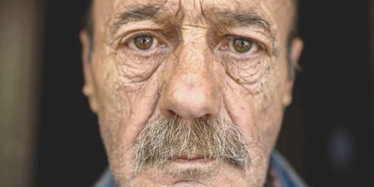 Cilt sıhhati ve yaşlanmaya bağlı hastalıklar ortasında nasıl bir bağlantı var?