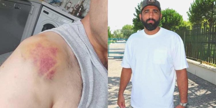 Çocuk parkında iki aile ortasında arbede: Havaya ateş açıldı!