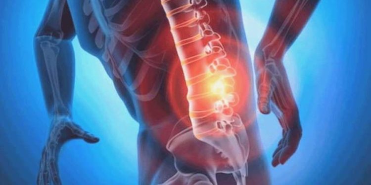 Fıtık Belirtileri Nelerdir? Fıtık Hakkında Bilmeniz Gerekenler