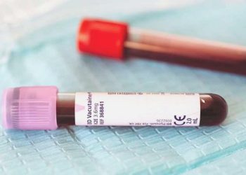 Genetik testlerin değeri: Pıhtılaşma ve inme olaylarında erken teşhis sağlıyor