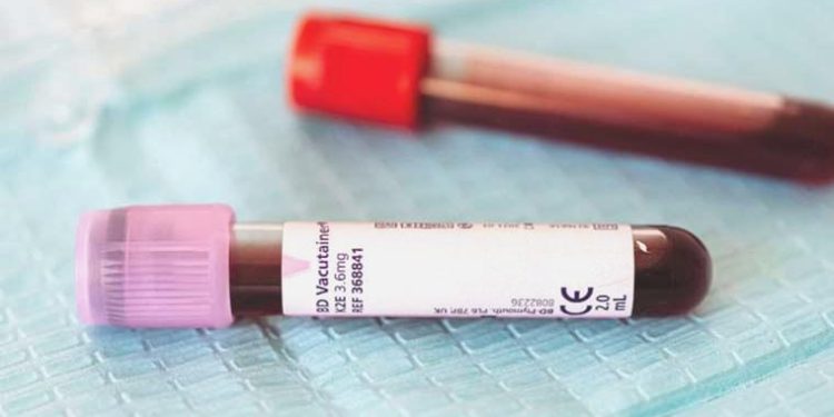 Genetik testlerin değeri: Pıhtılaşma ve inme olaylarında erken teşhis sağlıyor