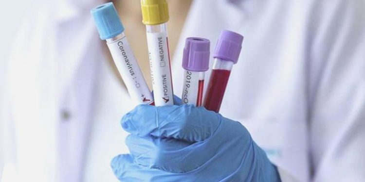 Koronavirüs Bilim Heyeti Üyesi Alper Şener’den ‘Eris’ varyantına ait açıklama: ”Yorum yapmak için çok erken’