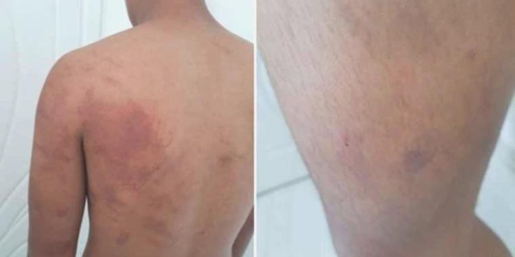 Şanlıurfa’da 15 yaşındaki çocuğa azap iddiası! Baba gözaltında