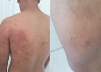 Şanlıurfa’da 15 yaşındaki çocuğa azap iddiası! Baba ve amca tutuklandı