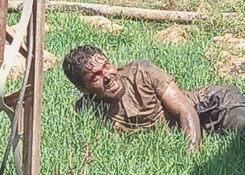 Şanlıurfa’da tedavi gören kuduz hastası hayatını yitirdi