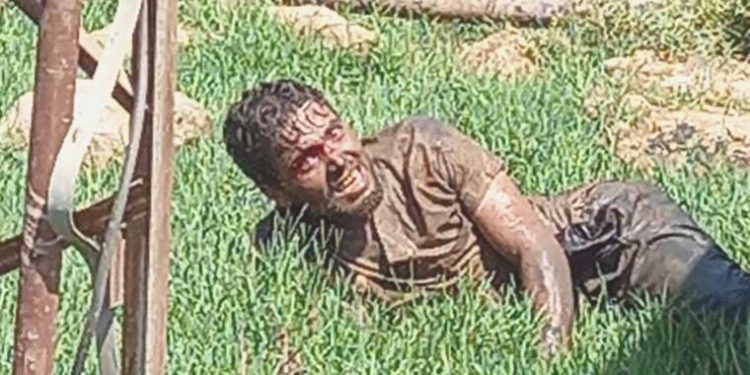 Şanlıurfa’da tedavi gören kuduz hastası ömrünü yitirdi