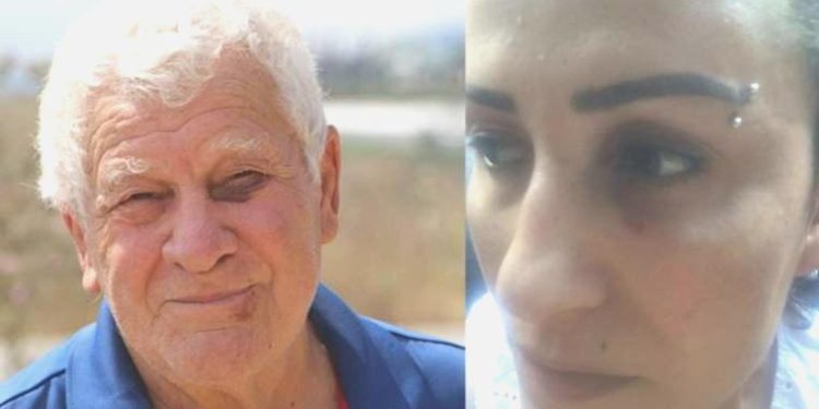 Sokak köpeklerini besledikleri için darbedildiler: ‘Kendisini savcı olarak tanıttı’