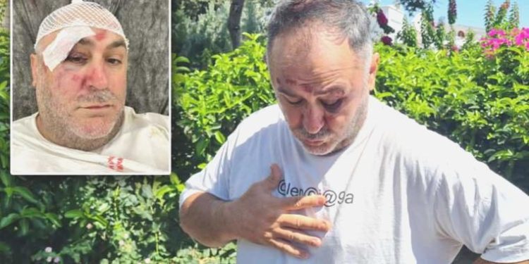 Spor yorumcusu ve işletmeci Levent Bulut öldüresiye darbedildi: ‘Organize formda hazırlık yapılmış’