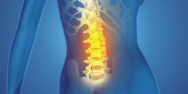 Bel fıtığına ne sebep olur? Tedavi prosedürleri nelerdir?