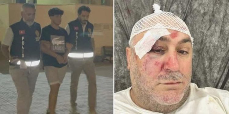 Çalışanları restoran sahibine ‘dambılla’ saldırıp gasbetti