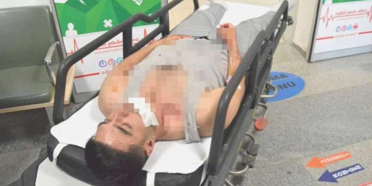 Otobüste ayağına bastığı yolcuyu darbedip, palayla yaraladı