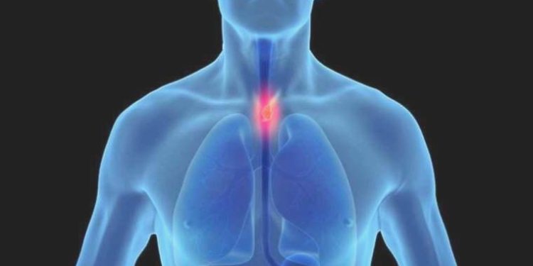 Yapay zekayla yemek borusu kanserinin evresini tespit eden sistem